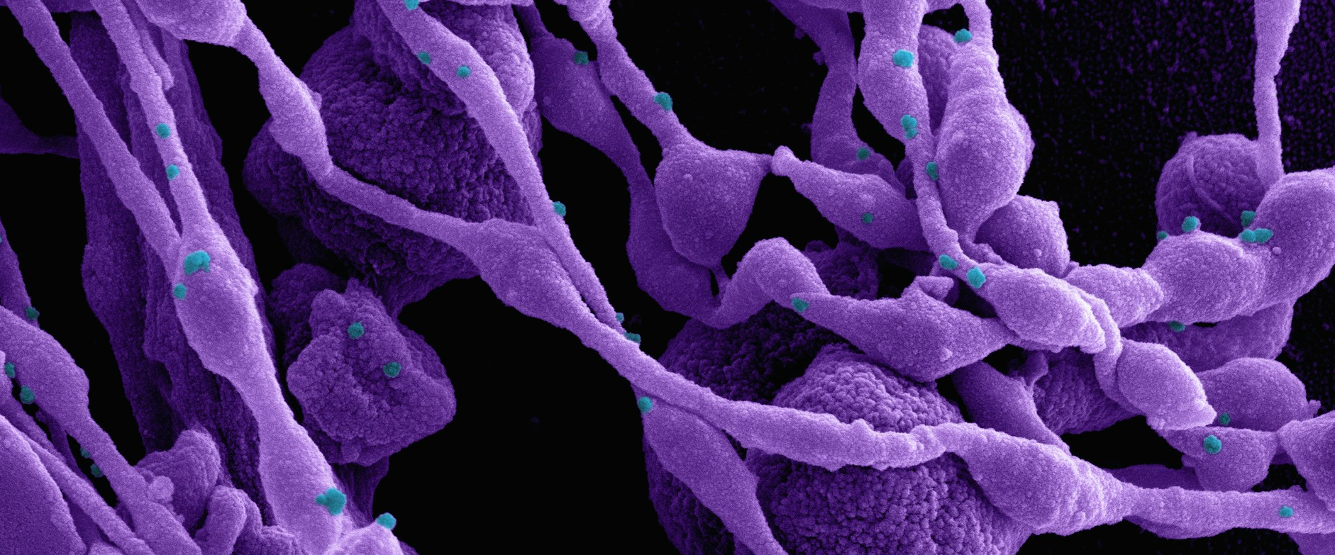 Microscopic image of disease.