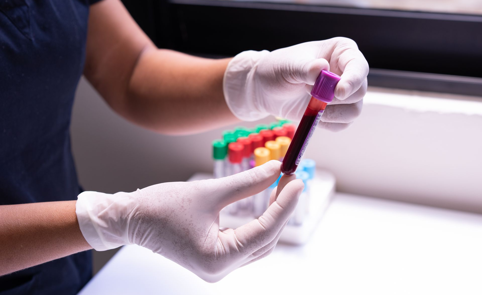 Gloved hands carefully handling a blood sample in a medical or laboratory environment.